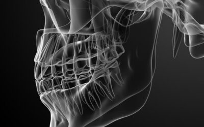 What Is Maxillofacial Prosthodontics?